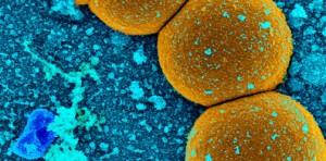 Methicillin-resistant Staphylococcus aureus. A bacteria that causes infections and is one that is resistant to many antibiotics.